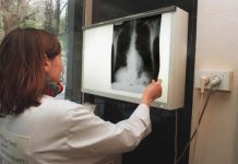 Crean por primera vez pulmones humanos en un laboratorio