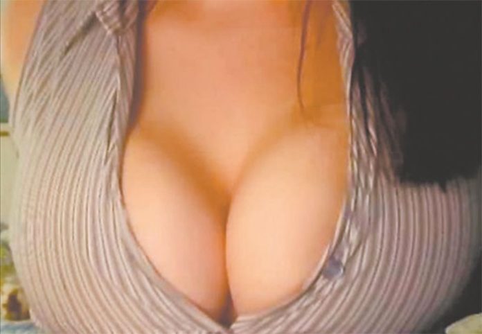 implantes