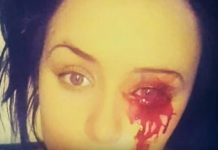Joven llora lágrimas de sangre y médicos no encuentran la causa