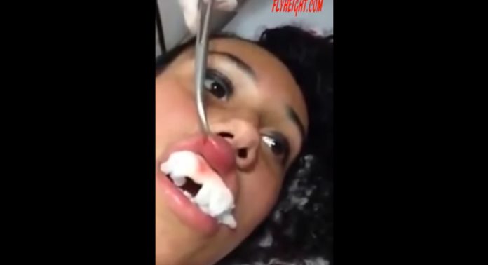 labio