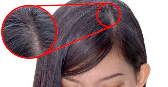 las-canas