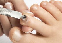 Le amputan un dedo tras hacerse mala pedicura