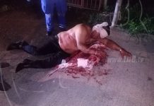 Accidente en la carretera vieja a León deja un lesionado de gravedad