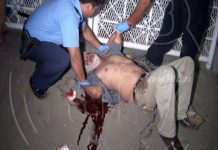 Dos motociclistas al accidentarse en peligrosa curva