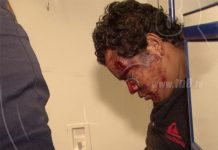Antisociales agreden violentamente a dos personas