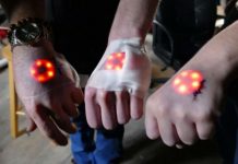 La última moda de los biohackers luces LED bajo la piel
