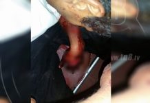 Nueva Segovia: Encapuchados machetean a maestro