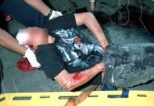Managua: Casi le parten la cara en dos de un machetazo