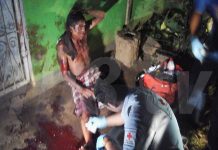 Hombre al borde de la muerte al ser brutalmente macheteado