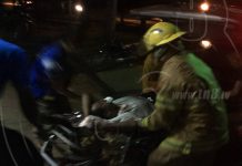 Anciano cae a manjol y pierde piezas dentales