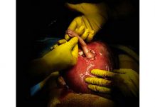 17 años después, ¡así luce el bebé que tomó la mano de doctor en plena cirugía!