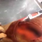 Lo mordió un tiburón, se filmó y publico las imágenes en las redes