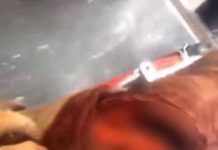 Lo mordió un tiburón, se filmó y publico las imágenes en las redes
