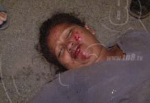 Mujer es arrollada en carretera a Xiloá