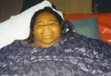 Fotos: Cómo queda el cuerpo de alguien que pierde 230 kilos