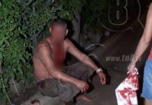 Managua: Le rajan la cabeza de una pedrada