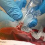 reino unido, niños, plasma contaminado, investigacion,