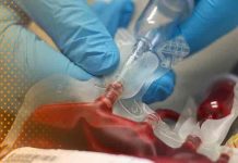 reino unido, niños, plasma contaminado, investigacion,
