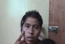 Nandaime: Mujer apaleada rompió el silencio