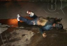 Estelí: Tomador sufre quemaduras de tercer grado