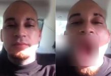 Rapero se disparó en la mejilla para nuevo videoclip