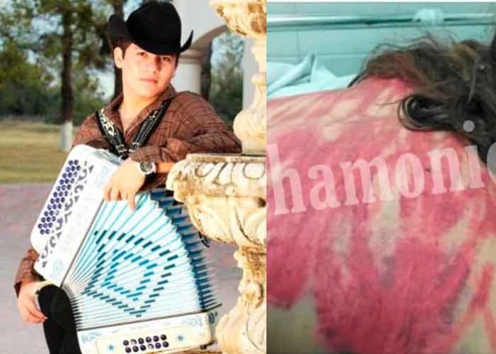 mexico, violencia domestica, fotos, agresiones, musica, remmy valenzuela, viral,