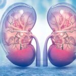 17 de junio: Día Mundial del Cáncer de Riñón riñon, enfermedad, dia mundial, cancer,