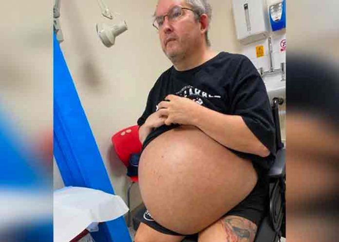 rinones-operacion- reino unido, riñones, medicina, cirugia,