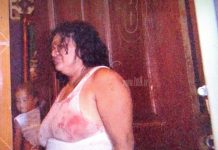 Managua: Señora es agredida sin compasión por su pareja