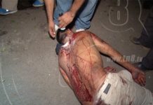 Hombre supuestamente se intenta cortar el cuello por la mujer