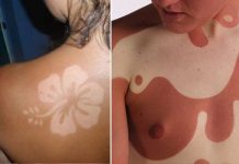 Curiosos tatuajes usando las quemaduras solares