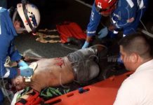 Peatón atropellado se debate entre la vida y la muerte