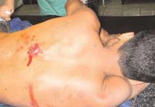 Por intento de violación, se gana su puñalada