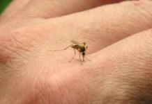Guatemala: Reportan casos de microcefalia por zika