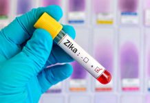 Cuba reporta octavo caso de zika
