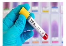 Bolivia: Mujeres embarazadas con zika dan a luz sin complicaciones