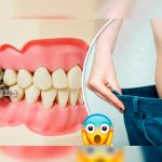 Crean dispositivo para que no puedas comer y bajes de peso salud, dieta, dispositivo,