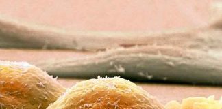 salud, sarcoma, sintomas, tratamiento, cancer