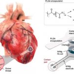 Investigadores crean el primer marcapasos sin cables ni baterías salud, ciencia, marcapasos transitorio, caracteristicas, novedades