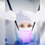 Suiza desarrolla la primera máquina que reproduce piel para injertos salud, ciencia, generacion de piel, caracteristicas, quemaduras