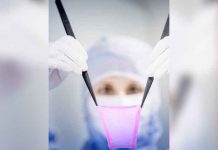 Suiza desarrolla la primera máquina que reproduce piel para injertos salud, ciencia, generacion de piel, caracteristicas, quemaduras