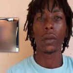 Hondureño roció ácido de batería a su expareja por no regresar con él