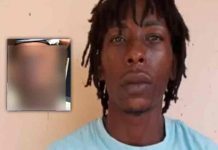 Hondureño roció ácido de batería a su expareja por no regresar con él