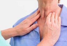 Esta enfermedad es la que provoca el cáncer de cabeza y cuello salud, enfermedad del beso, cancer de cabeza y cuello, enfermedad,