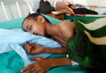 Brote de cólera en Nigeria suma 749 muertes