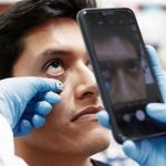 Con una simple foto con tu smartphone se puede detectar la anemia Foto: Con una simple imagen pueden detectar la anemia / Referencia