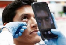 Foto: Con una simple imagen pueden detectar la anemia / Referencia
