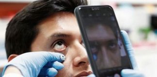 Foto: Con una simple imagen pueden detectar la anemia / Referencia