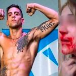 Argentina: Luchador de artes marciales desfiguró rostro de su pareja argentina, agresion, violencia de genero, luchador,