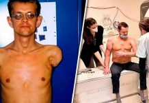 ¡Wow! Hombre que recibió primer trasplante de brazos ya puede mover sus bíceps ¡Wow! Hombre que recibió primer trasplante de brazos ya puede mover sus bíceps
